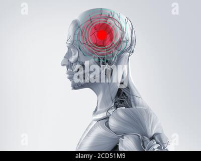 Human anatomy model showing a head, headache. Red spot in area of pain. Stock Photo