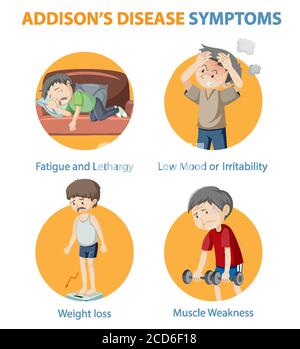 Medical infographic of Addison's disease symptoms illustration Stock ...