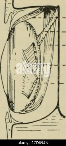 . Transactions . - Rect. ext.-J-- Nv. II. — Rect. iut. - - Rect. sup.— Obliq. sup. Rect. ext.Rect. sup.NV. II. Int. orlj, sept.Lig. teuac. oculi Rect. int. Xv. IV.•Oblici. inf.? Obliq. sup. Fig. 65.—Dorsal view of dissection of R. orbit of Pagelluscentrodontus (sea bream), x |. A fish of ordinary shape,and swimming on an oven keel. Fig. 66.—Dorsal view of dissection of E. orbit of Zeus faher(John Dory). x ^. A fish of very flat discoid shape, butwhich swims on an even keel. The M. obliqnus sviperior ofthe eye in each case has one of the three simple modes ofattachment to the i^lobe conmion to Stock Photo