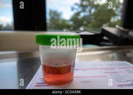 a histological tissue preparation after an operation is on a lab time Stock Photo