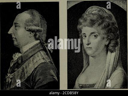 Hapsburg jaw - Stock Image - N516/0010 - Science Photo Library