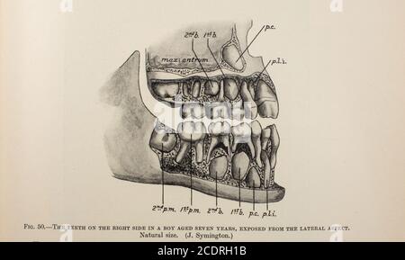 from Quain's Elements of Anatomy Col. III published in 1896, children's teeth. Stock Photo