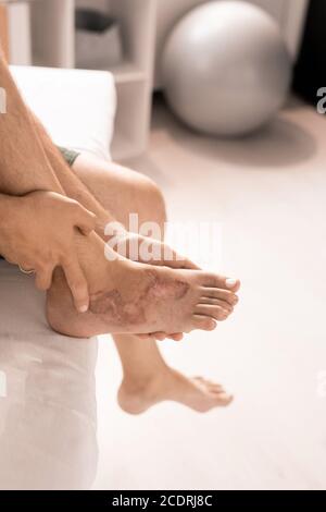 Hands of mature man with injured or burnt foot sitting on medical couch Stock Photo
