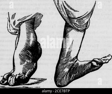 The Hydropathic Family Physician A Ready Prescriber And Hygienic Adviser With Reference To The Nature Causes Prevention And Treatment Of Diseases Accidents And Casualties Of Every Kind Obsk Foot The Hydropathic Family Physician A Ready Prescriber And Hygienic Adviser With Reference To The Nature Causes Prevention And Treatment Of Diseases Accidents And Casualties Of Every Kind Obsk Foot