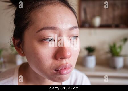 Sick ethnic female crying while having flu and headache looking away Stock Photo