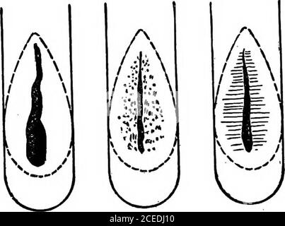 . A laboratory guide in bacteriology, for the use of students, teachers, and practitioners. Fig. 21Streak Cultures Stock Photo