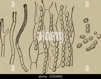 . Essentials of laboratory diagnosis; designed for students and practitioners. idia are en-capsulated or are strung together like the beads of a necklace,and appear as round, oval, angular, or very irregularly con-toured bodies. These mycelial threads branch at right angles;the spores measure from 3 to 10 microns in diameter (Hyde). Trichophyton Megalosporon Endothrix.—This organism isthe cause of tinea circinata (herpes tonsurans, ringworm of the 164 VEGETABLE PARASITES body) and of tinea sycosis (tinea barbae, ringworm of the beard,barbers itch). The trichophyton is composed of spores, which Stock Photo