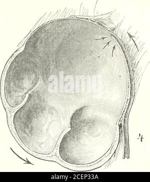 . Diseases of the kidneys, ureters and bladder, with special reference to the diseases of women. Stock Photo