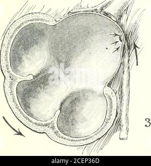 . Diseases of the kidneys, ureters and bladder, with special reference to the diseases of women. /^/- ^^^^^ V. Stock Photo