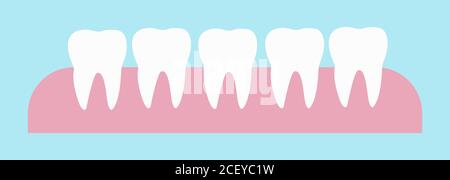 5 healthy teeth on the gums vector llustration. The result of teeth whitening Stock Vector