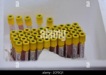 A view of collected blood samples during the serological survey sampling at the Anganwadi Center.Health workers collects blood samples for Covid-19 antibody test during a serological survey at the Anganwadi Center near ITO in New Delhi. Serological survey conducted by "the Indian Council of Medical Research in collaboration with state health departments, National Centre for Disease Control and World Health Organization". The First Serological Survey conducted was in May 2020 and second was in July 2020. The first part of the survey aimed at detecting the number of people infected with COVID-19 Stock Photo