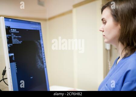 Female doctor using digital equipment for mammography Stock Photo