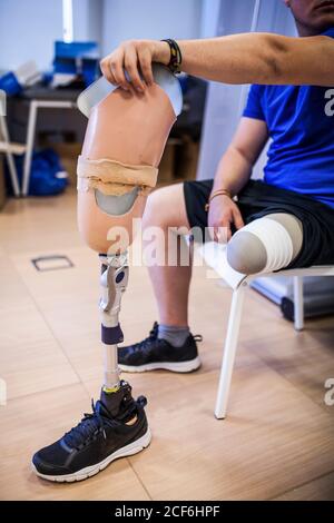 amputated young man testing the new leg prosthesis Stock Photo
