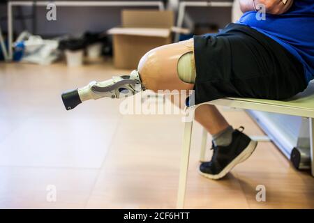 amputated young man testing the new leg prosthesis Stock Photo