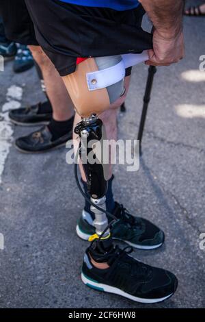 unrecognizable young man amputated with his leg prosthesis Stock Photo