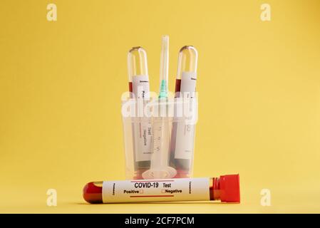 Test tubes with blood samples and syringe used for COVID 19 diagnostic on yellow background Stock Photo