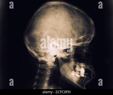 Human skull x-ray image of adult woman head isolated on black background Stock Photo