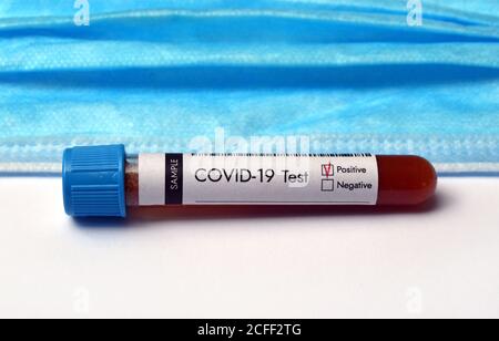 Test-tube with coronavirus test blood sample positive result. Close-up view with face mask on white background Stock Photo