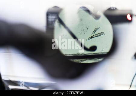 Top view of hair with small parasites placed under lens of modern microscope in laboratory Stock Photo