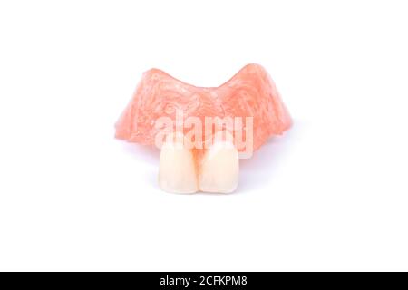 Acrylic dentures isolated on white background. Removable dentures flexible. False teeth. Stock Photo