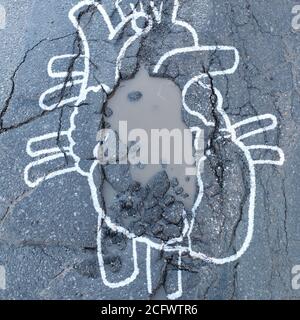 Heart disease concept and cardiology illness as a broken anatomy and damaged vascular system. Stock Photo