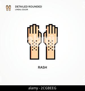 Human Hand with Heat Rash illustration Stock Vector Image & Art - Alamy