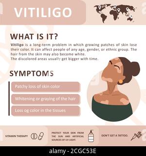 Infographics of vitiligo. Symptoms of the disease. Abstract woman silhouette. Vector concept to support people living with vitiligo and to build Stock Vector
