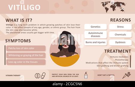 Infographics of vitiligo. Causes of the disease. Abstract african woman silhouette. Vector concept to support people living with vitiligo and to build Stock Vector