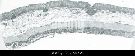 . The medical and surgical history of the war of the rebellion. (1861-65). Prepared, in accordance with the acts of Congress, under the direction of Surgeon general Joseph K. Barnes, United States army . Pig. 2(1,—Diagram explanatory of the plate facing p. ij70. A. Mucous mem-brane; a, a, a, a, glands of Lieberkiihn. B. JIuscle of Briicke. C.-Submucousconnective tissue infiltrated, especially near the muscle of Briicke, with lymphoidelements: &. b, b, b, bloodvessels cut across filled with coagula. D. Circular,E, longitudinal, coat of the intestine ; in the latter, on the right, the cut passes Stock Photo