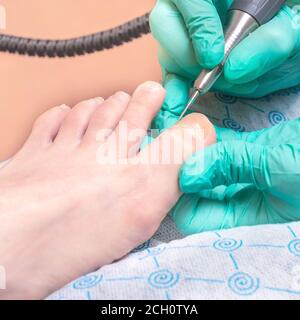 Professional hardware pedicure using electric machine.Patient on medical pedicure procedure, visiting podiatrist. Stock Photo