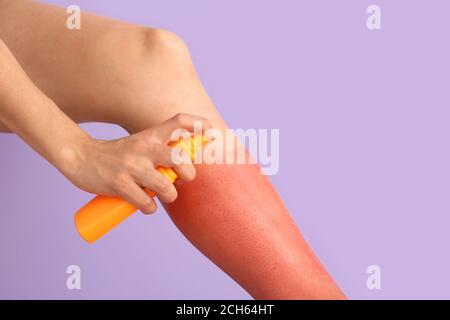 Woman with red sunburned skin applying cream against color background Stock Photo