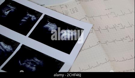 Ultrasound scan report and Electrocardiogram reading Stock Photo