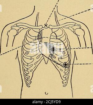 jugular notch