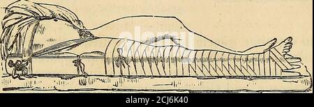The principles and practice of modern surgery . FRACTURES OF THE ...