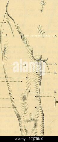 . Elektrizitätslehre für Mediziner und Elektrotherapie . extensor pollicislongus und ind. propr. § 103. Untere Extremität. Nervus cruralis. 255 § 103. Untere Extremitäten. Wegen der bedeutenderenDicke des Fettpolsters und der Haut selbst, namentlich der Epidermis,müssen hier meist kräftigere Ströme, als an den oberen Extremitätenangewendet werden. Oft ist wegen des Eintritts der motorischenNerven von der Tiefe her nur eine direkte Mukelreizung zu ermög-lichen: noch mehr wie ah den Oberextremitäten sind hier besondersam Unterschenkel die Reizungen der Nerven mit lebhaften Schmerz-erregungen der Stock Photo