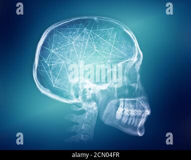 Human skull X-ray image. Artificial intelligence concept Stock Photo