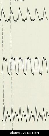 . The Bell System technical journal . Pig 37—Slow record of signal detected from tone modulated transmission showing the night-time distortion. Made at Stamford, Conn., May 15, 1924, 2:25 a.m. Upper trace signal from vertical antenna receiver and lower trace signal from loop antenna receiver, timing ,marks 2.6 seconds apart Loop 148 149 150. Antenna Stock Photo