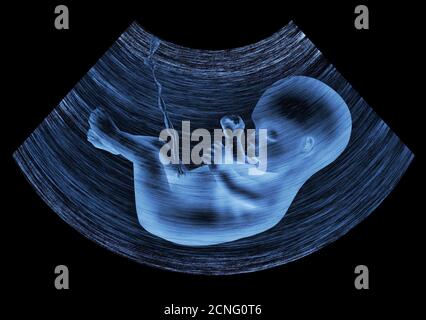 ultrasound baby Stock Photo