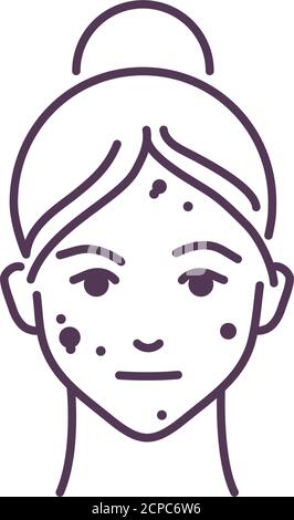 Acne on the female face line black icon. Skin rash. Dermatological diseases. Sign for web page, mobile app, button, logo. Vector isolated illustration Stock Vector