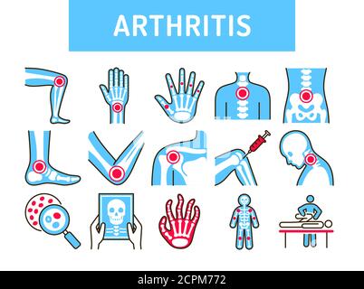 Arthritis human body line color icons set. Inflammation joints. Signs for web page, mobile app, button, logo. Editable stroke. Stock Vector