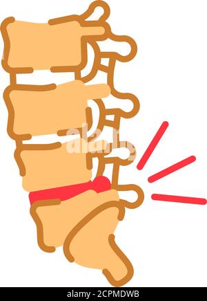 Lumbar osteochondrosis flat color icon. Orthopedics diseases. Pain in spine, bone illness. Sign for web page, mobile app, button, logo. Vector Stock Vector