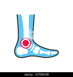 Ankle arthritis line color icon. Inflammation joint. Sign for web page, mobile app, button, logo. Editable stroke. Stock Vector