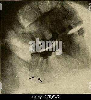 . Elementary and dental radiography . Fig- -M... Fig. 247. Fig. 246 ...