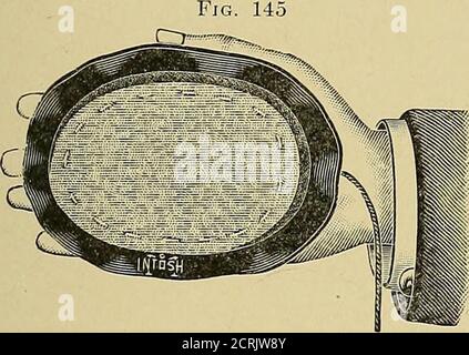 . Electricity : its medical and surgical applications, including radiotherapy and phototherapy . Covered conducting cords for electrodes.. Sponge-covered electrode, insulated with soft rubber forgeneral application with the hand. Fig. 146 Stock Photo