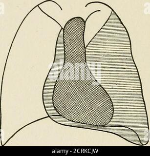 . Radio-diagnosis of pleuro-pulmonary affection . seased side, while the normal sideretains all its clearness. This obscurity is nearly uniform,but more intense, however, obliquely from the base. At thislevel it becomes impossible to distinguish the contour of thediaphragm, as the respiratory movements are abolished, orthe lateral cul-de-sac, which is completely effaced by theeffusion. At the top a clearness persists which is the more 15 16 RADIO-DIAGNOSIS: PLEURAE decreased and obscured the more abundant the effusion.Under the pressure of the fluid a lateral deformation is pro-duced correspon Stock Photo