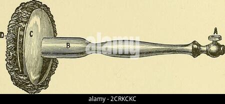 . The medical and surgical uses of electricity : including the X-ray, Finsen light, vibratory therapeutics, and high-frequency currents . Fig. 80,—Universal Handle.. Fig. 81.—United Clasp and Handle with Sponge attached (Kidder). Stock Photo
