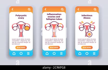 Female reproductive disease on mobile app onboarding screens. Stock Vector