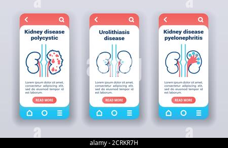 Kidney disease on mobile app onboarding screens. Line icons, polycystic, urolithiasis disease, pyelonephritis. Stock Vector