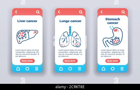 Malignant neoplasm, metastases on mobile app onboarding screens. UI UX GUI template. Stock Vector