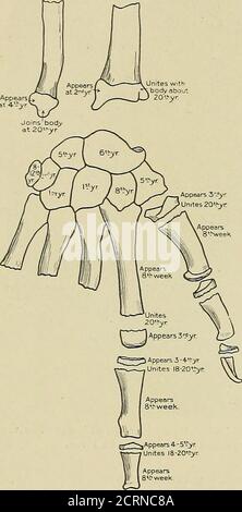 . Radiography and radio-therapeutics . trapezoid, trapezium, os magnum ...